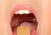 How to get rid of tonsil stones? How to get rid of tonsil stones?